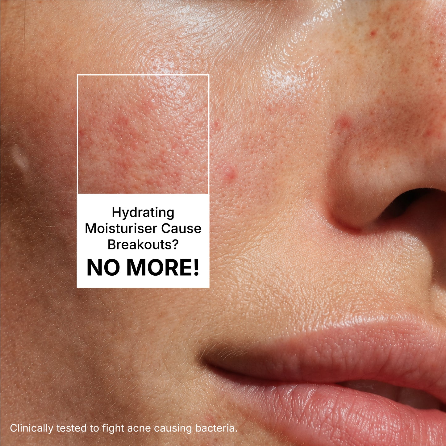 LONGÈVE BLEND™ Mattifying Hydra all day cream