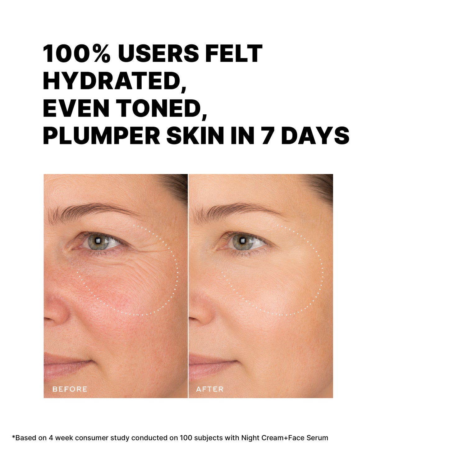 1% MATRIXYL®3000 Microencapsulated Repairing Serum