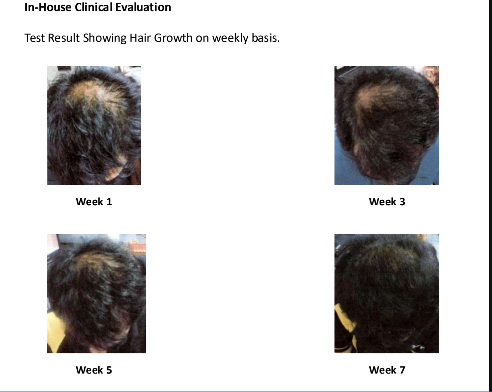 Follicle Activation Trio