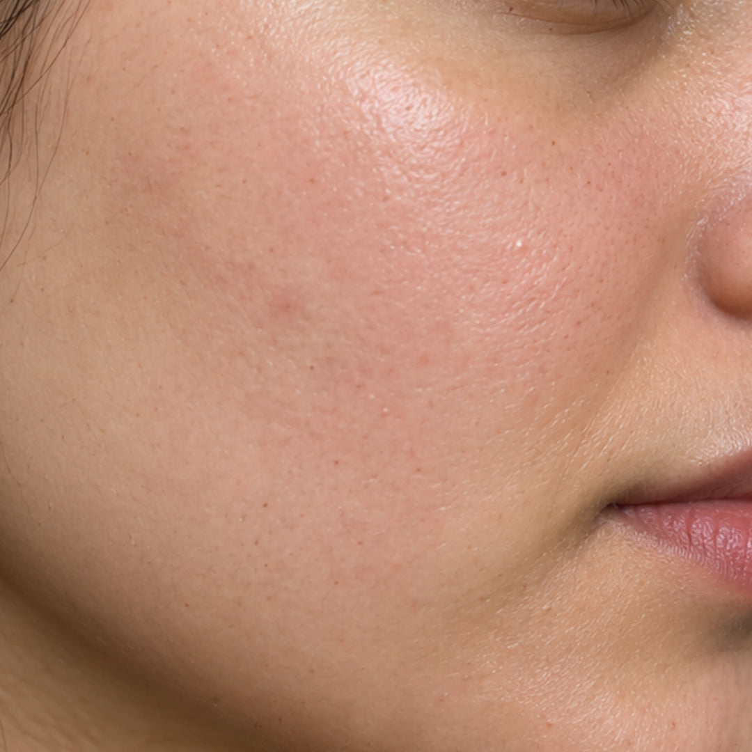 After